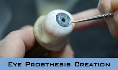 Eye Prosthesis Creation