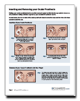 PDF article image ophthalmologist ocularist5