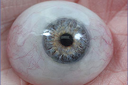 eye prosthesis prosthetic eye ocular prosthesis 1