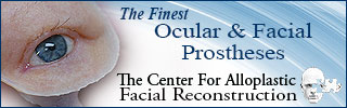 the center for alloplastic facial reconstruction banner